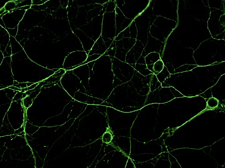 Tau expression in cell cultures