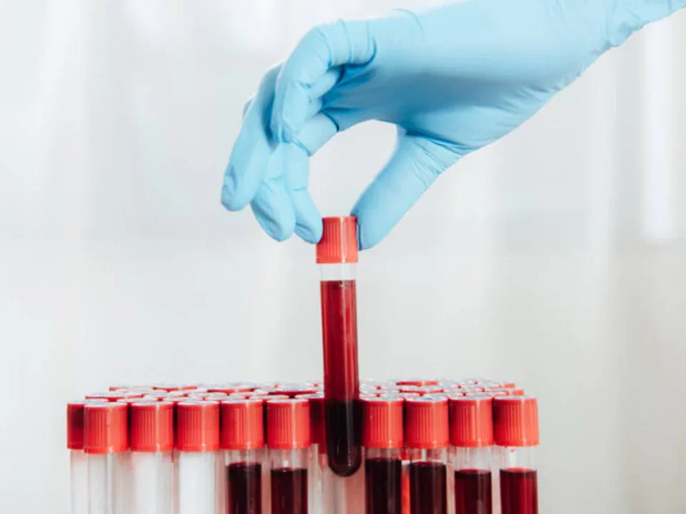 Doctor holding blood sample tube