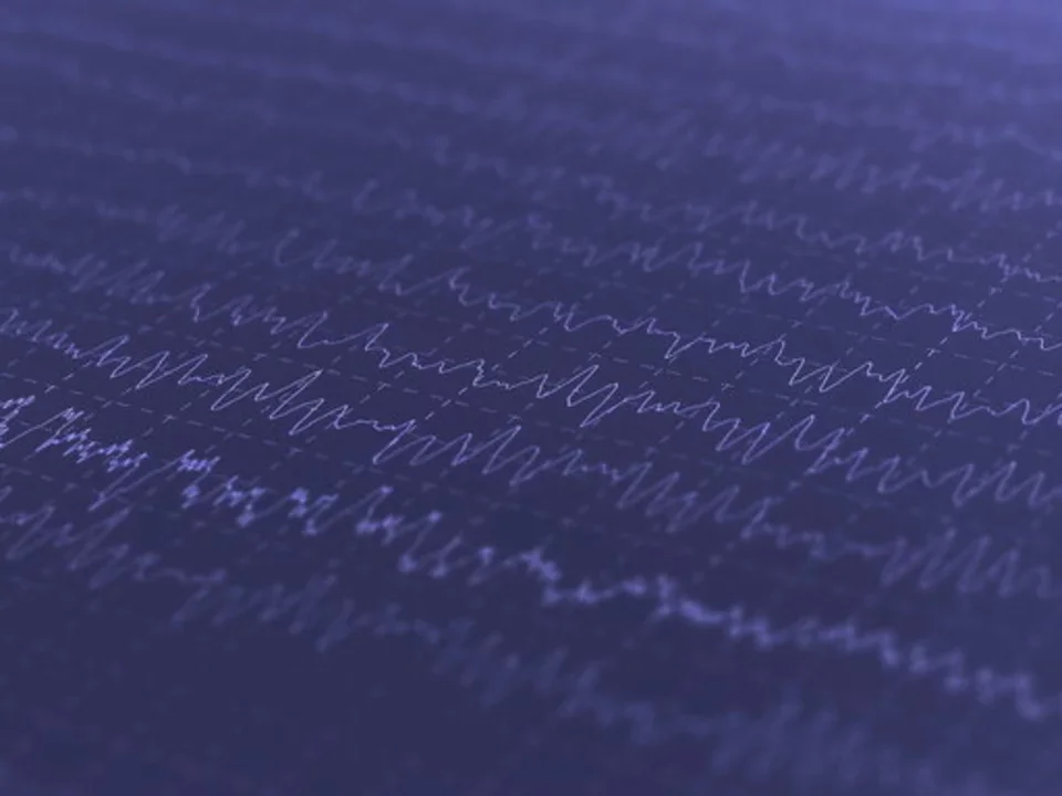 Brain wave oscillations (EEG)
